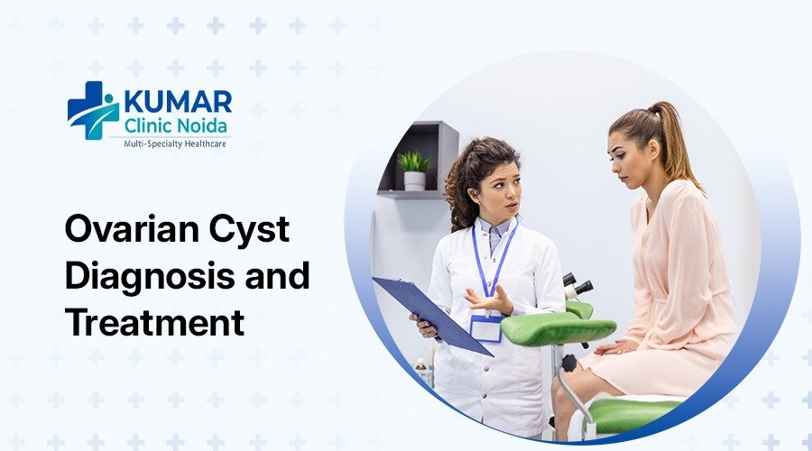 Ovarian cyst diagnosis and treatment